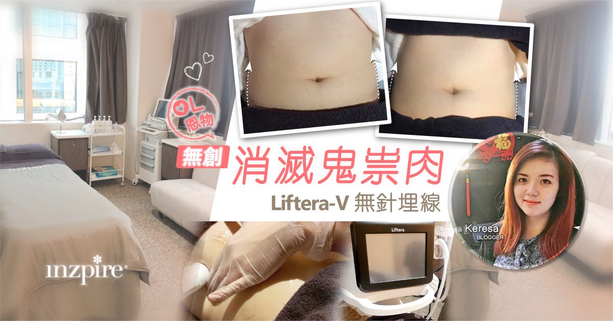 無創消滅鬼祟肉！Liftera-V無針埋線