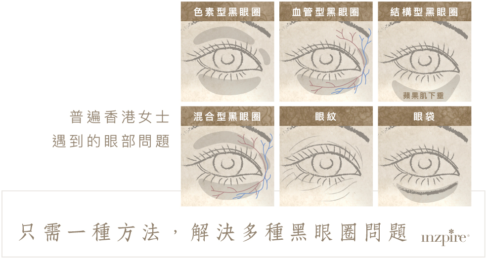 Inzpire經絡磁療活眼經療法 常見眼部問題 去眼袋 去黑眼圈